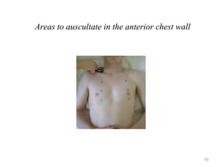 Areas to auscultate in the anterior chest wall
65
 