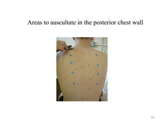 Areas to auscultate in the posterior chest wall
66
 