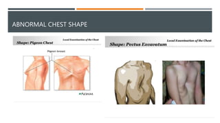 Respiratory system examination | PPTX