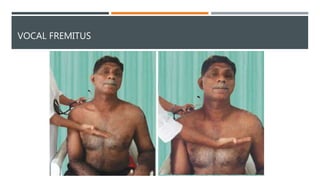Respiratory system examination | PPTX