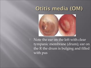 Respiratory system in children | PPT