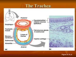 The Trachea




Copyright © 2008 Pearson Education, Inc., publishing as Benjamin Cummings   Figure 21.7a, b
 