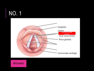 NO. 1
Ventricular
folds
Answer
 