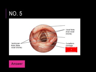 NO. 5
Cornicula
r
cartilage
Answer
 