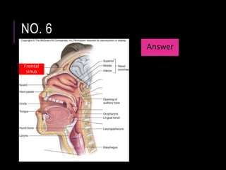 NO. 6
Frontal
sinus
Answer
 
