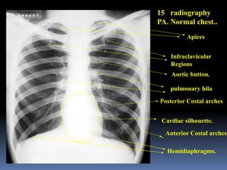 RESPIRATORY SYSTEM JXSGJMCGHJTUTORIAL.pptx