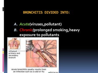 Respiratory tract infections | PPTX