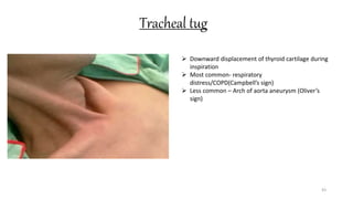 Tracheal tug
43
 Downward displacement of thyroid cartilage during
inspiration
 Most common- respiratory
distress/COPD(Campbell’s sign)
 Less common – Arch of aorta aneurysm (Oliver’s
sign)
 