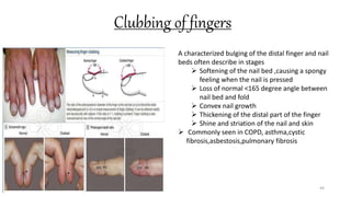 Clubbing of fingers
44
A characterized bulging of the distal finger and nail
beds often describe in stages
 Softening of the nail bed ,causing a spongy
feeling when the nail is pressed
 Loss of normal <165 degree angle between
nail bed and fold
 Convex nail growth
 Thickening of the distal part of the finger
 Shine and striation of the nail and skin
 Commonly seen in COPD, asthma,cystic
fibrosis,asbestosis,pulmonary fibrosis
 