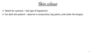 Skin colour
 Watch for cyanosis – late sign of hypoxemia
 For dark skin patient – observe in conjunctiva, lips,palms, and under the tongue
49
 