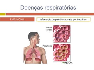 RespiratóRio II