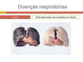RespiratóRio II