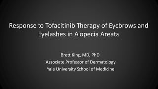 Response to Tofacitinib Therapy of Eyebrows and
Eyelashes in Alopecia Areata
Brett King, MD, PhD
Associate Professor of Dermatology
Yale University School of Medicine
 