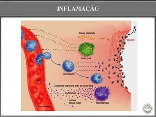INFLAMAÇÃO
 
