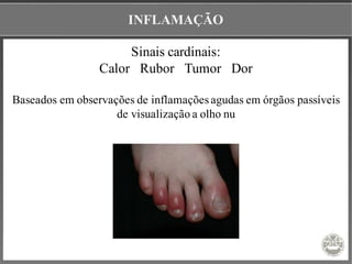 INFLAMAÇÃO
Sinais cardinais:
Calor Rubor Tumor Dor
Baseados em observações de inflamações agudas em órgãos passíveis
de visualização a olho nu
 