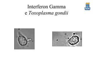 Interferon Gamma
e Toxoplasma gondii

 