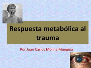 Respuesta metabólica al
trauma
Por Juan Carlos Molina Munguia
 