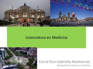 Licenciatura en Medicina Corral Ruiz Gabriella Montserrat. Respuesta de citocinas a lesiones. 
