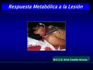 Respuesta Metabólica a la Lesión
M.C.C.G. Erick Castillo Alvarez
 