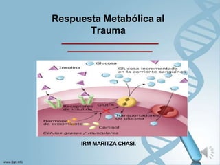 IRM MARITZA CHASI.
Respuesta Metabólica al
Trauma
 