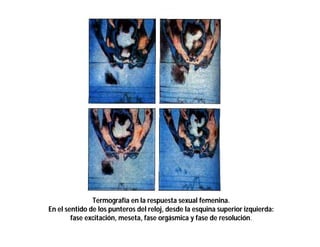 Termografía en la respuesta sexual femenina.
En el sentido de los punteros del reloj, desde la esquina superior izquierda:
fase excitación, meseta, fase orgásmica y fase de resolución.

 