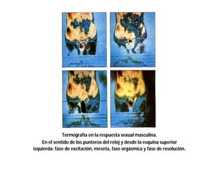 Termografía en la respuesta sexual masculina.
En el sentido de los punteros del reloj y desde la esquina superior
izquierda: fase de excitación, meseta, fase orgásmica y fase de resolución.

 