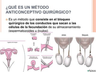Respuesta sexual humana y metodos anticonceptivos
