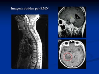 Imagens obtidas por RMN
 