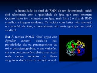 A intensidade do sinal da RMN de um determinado tecido
está relacionada com a quantidade de água que estes possuem.
Quanto maior for o conteúdo em água, mais forte é o sinal da RMN
e melhor a imagem resultante. Os tecidos com lesões têm alteração
no conteúdo de água, e normalmente têm mais água que um tecido
saudável.
Ex: A técnica BOLD (blood oxygen level
dependent contrast) baseia-se nas
propriedades dia ou paramagnéticas da
oxi e desoxiemoglobina, e nas variações
em suas concentrações relativas nas áreas
onde ocorre aumento do fluxo
sanguíneo decorrente da ativação neural.
 