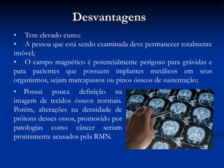 Desvantagens
• Tem elevado custo;
• A pessoa que está sendo examinada deve permanecer totalmente
imóvel;
• O campo magnético é potencialmente perigoso para grávidas e
para pacientes que possuem implantes metálicos em seus
organismos, sejam marcapassos ou pinos ósseos de sustentação;
• Possui pouca definição na
imagem de tecidos ósseos normais.
Porém, alterações na densidade de
prótons desses ossos, promovido por
patologias como câncer seriam
prontamente acusados pela RMN.
 