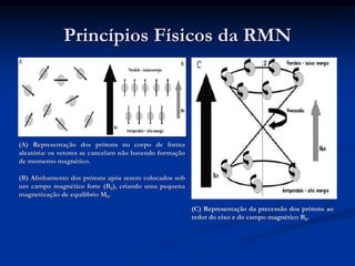 (B) Alinhamento dos prótons após serem colocados sob
um campo magnético forte (B0), criando uma pequena
magnetização de equilíbrio M0.
(C) Representação da precessão dos prótons ao
redor do eixo z do campo magnético B0.
(A) Representação dos prótons no corpo de forma
aleatória: os vetores se cancelam não havendo formação
de momento magnético.
Princípios Físicos da RMN
 