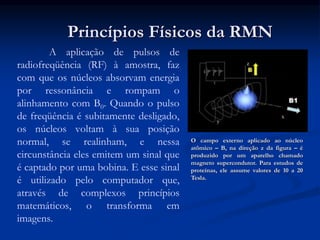 A aplicação de pulsos de
radiofreqüência (RF) à amostra, faz
com que os núcleos absorvam energia
por ressonância e rompam o
alinhamento com B0. Quando o pulso
de freqüência é subitamente desligado,
os núcleos voltam à sua posição
normal, se realinham, e nessa
circunstância eles emitem um sinal que
é captado por uma bobina. E esse sinal
é utilizado pelo computador que,
através de complexos princípios
matemáticos, o transforma em
imagens.
Princípios Físicos da RMN
O campo externo aplicado ao núcleo
atômico – B, na direção z da figura – é
produzido por um aparelho chamado
magneto supercondutor. Para estudos de
proteínas, ele assume valores de 10 a 20
Tesla.
 