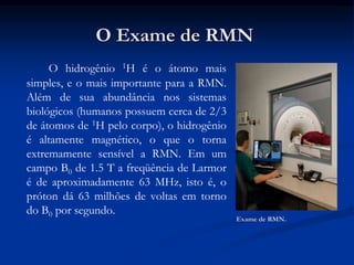 O hidrogênio 1H é o átomo mais
simples, e o mais importante para a RMN.
Além de sua abundância nos sistemas
biológicos (humanos possuem cerca de 2/3
de átomos de 1H pelo corpo), o hidrogênio
é altamente magnético, o que o torna
extremamente sensível a RMN. Em um
campo B0 de 1.5 T a freqüência de Larmor
é de aproximadamente 63 MHz, isto é, o
próton dá 63 milhões de voltas em torno
do B0 por segundo.
O Exame de RMN
Exame de RMN.
 