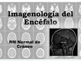 Imagenología del
Encéfalo
RM Normal de
Cráneo
Cortes Axiales
Iniciar
 