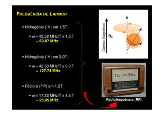 Hidrogênio (1H) em 1.5T:
ω = 42.58 MHz/T x 1.5 T
= 63.87 MHz
FREQUÊNCIA DE LARMOR
Hidrogênio (1H) em 3.0T:
CampoMagnético
B0
Hidrogênio ( H) em 3.0T:
ω = 42.58 MHz/T x 3.0 T
= 127.74 MHz
Fósforo (31P) em 1.5T:
ω = 17.23 MHz/T x 1.5 T
= 25.85 MHz Radiofrequência (RF)
 