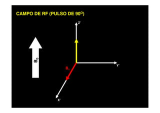 CAMPO DE RF (PULSO DE 90O)
Z’
X’
Y’
B0
B1
 
