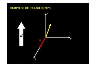 Z’
CAMPO DE RF (PULSO DE 90O)
X’
Y’
B0
B1
 