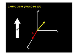 Z’
CAMPO DE RF (PULSO DE 90O)
X’
Y’
B0
B1
 