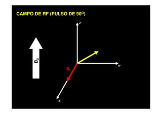 Z’
CAMPO DE RF (PULSO DE 90O)
X’
Y’
B0
B1
 