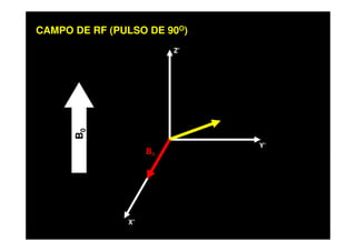 Z’
CAMPO DE RF (PULSO DE 90O)
X’
Y’
B0
B1
 