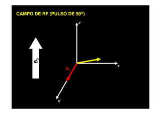 Z’
CAMPO DE RF (PULSO DE 90O)
X’
Y’
B0
B1
 
