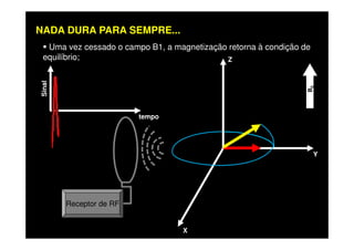Uma vez cessado o campo B1, a magnetização retorna à condição de
equilíbrio; Z
B0
tempo
Sinal
NADA DURA PARA SEMPRE...
X
Y
Receptor de RF
 