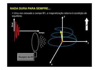 Uma vez cessado o campo B1, a magnetização retorna à condição de
equilíbrio; Z
B0
tempo
Sinal
NADA DURA PARA SEMPRE...
X
Y
Receptor de RF
 