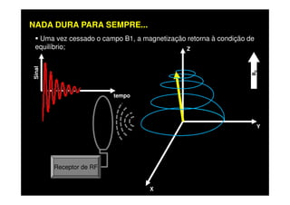 Uma vez cessado o campo B1, a magnetização retorna à condição de
equilíbrio; Z
B0
tempo
Sinal
NADA DURA PARA SEMPRE...
X
Y
Receptor de RF
 