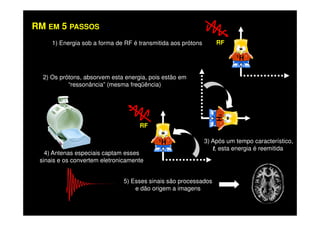 2) Os prótons, absorvem esta energia, pois estão em
“ressonância” (mesma freqüência)
1) Energia sob a forma de RF é transmitida aos prótons RF
1H
RM EM 5 PASSOS
5) Esses sinais são processados
e dão origem a imagens
4) Antenas especiais captam esses
sinais e os convertem eletronicamente
3) Após um tempo característico,
t, esta energia é reemitida
1H
RF
1H
 
