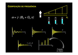 ω = γ (B0 + Gx x)
CODIFICAÇÃO DE FREQUÊNCIA
Gx
B0
1 2 3
1 2 3
ttt
1 + 2 + 3
t ω
Projeção
do Objeto
 
