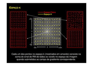 +Gy .
.
.
.
.
.
.
.
.
.
.
.
.
.
.
.
.
.
.
.
.
.
.
.
.
.
.
.
.
.
.
.
.
.
.
.
.
.
.
.
.
.
.
.
.
.
.
.
.
.
.
.
.
.
.
.
.
.
.
.
.
.
.
.
.
.
0
Espaço Físico
Espaço K
ESPAÇO K
.
.
.
.
.
.
.
.
.
.
.
.
.
.
.
.
.
.
.
.
.
.
.
.
.
.
.
.
.
.
.
.
.
.
.
.
.
.
.
.
.
.
.
.
+Gx-Gx 0
-Gy
Cada um dos pontos no espaço k (mostrados em amarelo) consiste na
soma do sinal de RM de todos os voxels no espaço da imagem
quando submetidos ao campo de gradiente correspondente.
 
