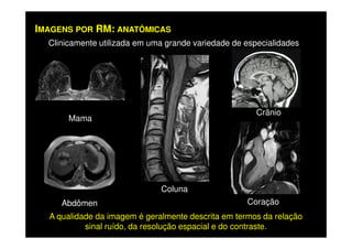 IMAGENS POR RM: ANATÔMICAS
Clinicamente utilizada em uma grande variedade de especialidades
Mama
Crânio
Abdômen
Coluna
Coração
A qualidade da imagem é geralmente descrita em termos da relação
sinal ruído, da resolução espacial e do contraste.
 
