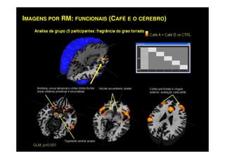 IMAGENS POR RM: FUNCIONAIS (CAFÉ E O CÉREBRO)
 