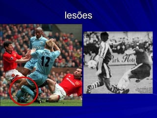 lesões 